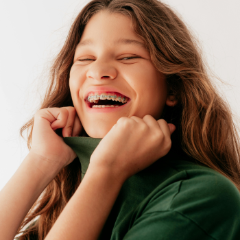 Dental Braces