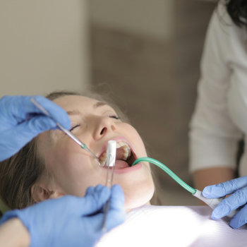Dental Bridges