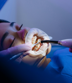 Dentures ​