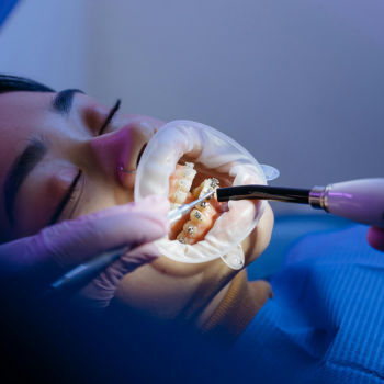 Dentures ​