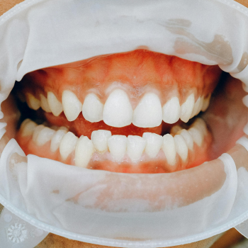 Oral Cance